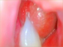 ???? La mejor cámara dentro del coño porno - enorme creampie en modelo rubia de su cuello uterino - pareja - pareja